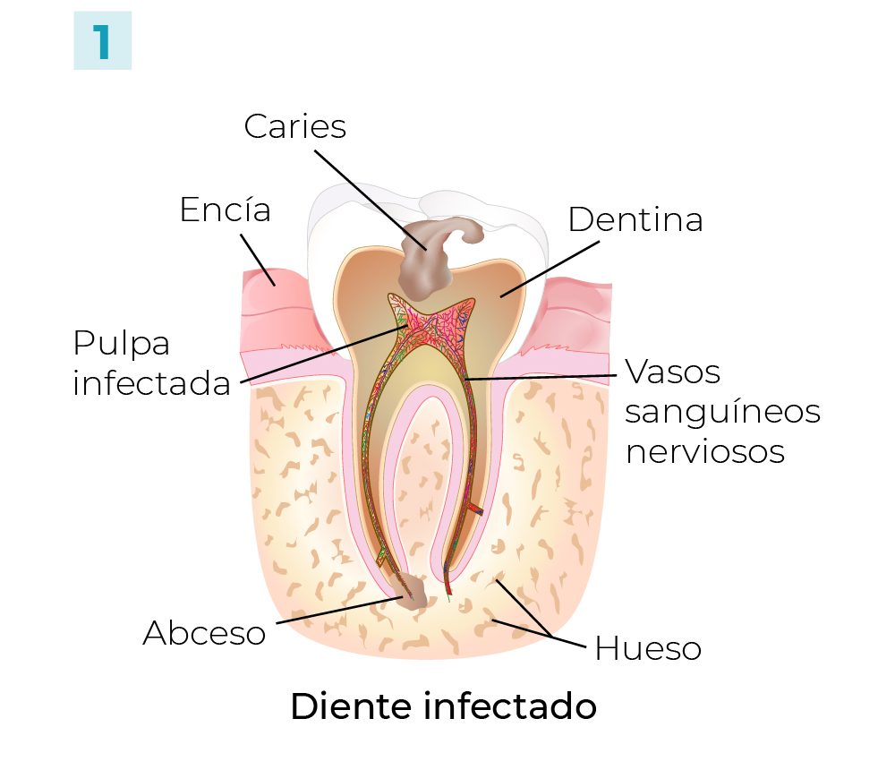 Pasos Conducto