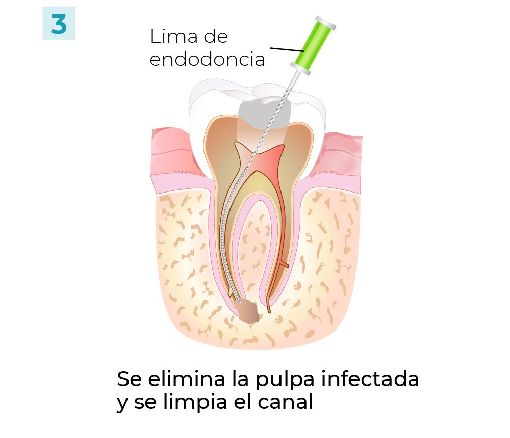 Pasos Conducto