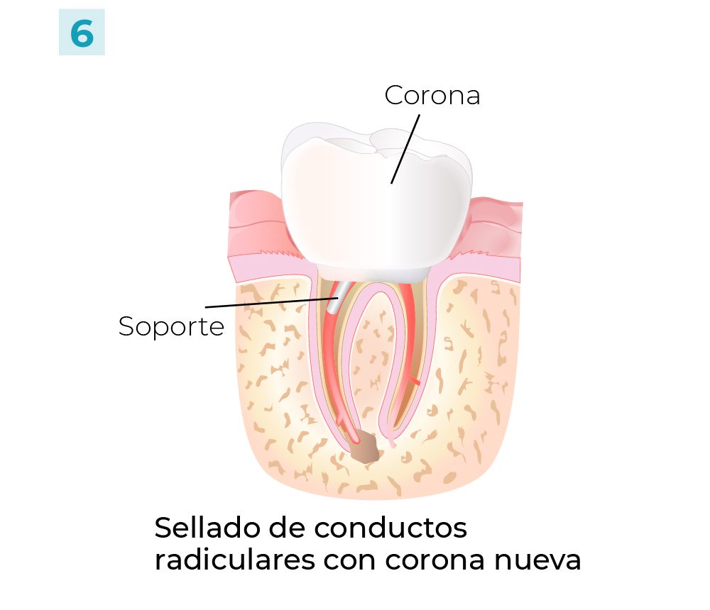 Pasos Conducto